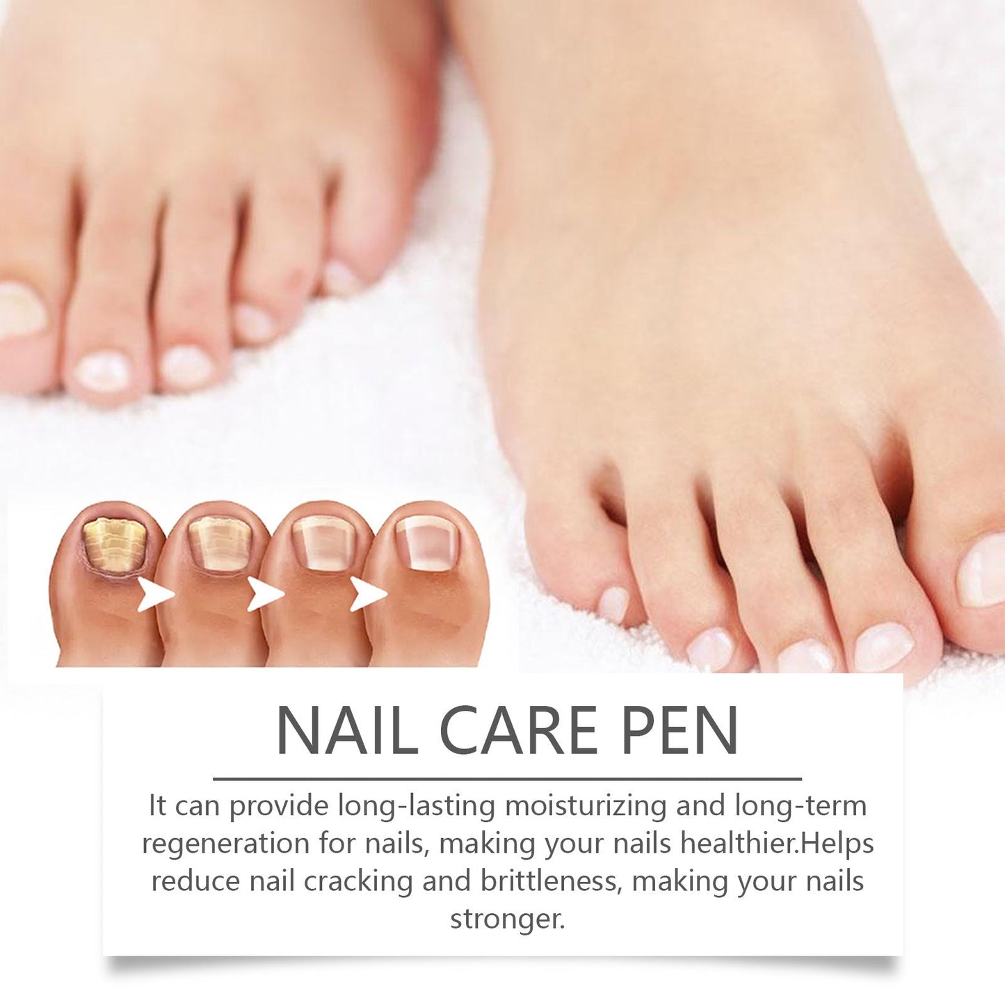 SassyTip Nail Care Pen β Nourish, Repair & Shine On-the-Go