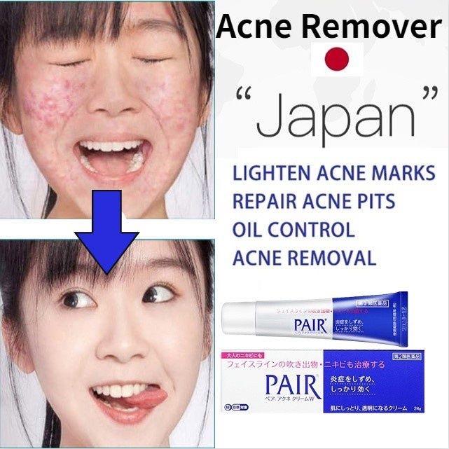 Lion Pair Acne Cream – Targeted Care for Clearer Skin