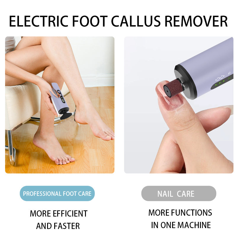 Electric Callus Remover – Smooth, Soft Feet in Minutes