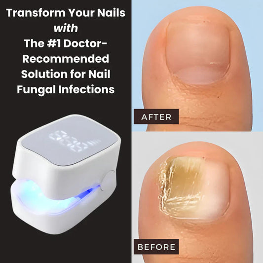 Nail Fungus Treatment Solutions 